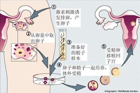 单基因病案例